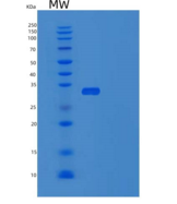 人UBE2J2重组蛋白