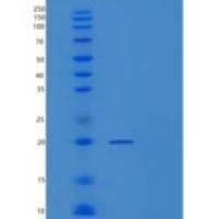 人TSEN15重组蛋白