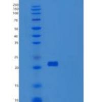 人尿溶蛋白3A(UPK3A)重组蛋白