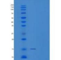 人TP53AIP1重组蛋白