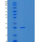 人UBE2L6重组蛋白
