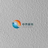 人前列腺上皮细胞