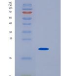 人肿瘤易感基因101(TSG101)重组蛋白