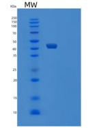 人泛素样修饰激活酶5(UBA5)重组蛋白