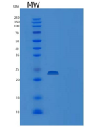 人骨骼肌慢肌肌钙蛋白I(TNNI1)重组蛋白