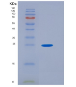 人泛素D(UBD)重组蛋白