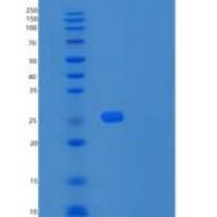 人UBE2E3重组蛋白