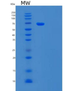 人尿苷二磷酸糖基转移酶8(UGT8)重组蛋白