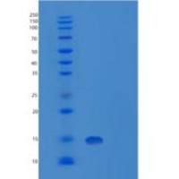 人肿瘤抑制候选基因2(tus C2)重组蛋白