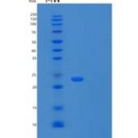 人UBE2E1重组蛋白