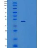 人Toll相互作用蛋白(TOLLIP)重组蛋白