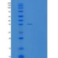 人硫氧还蛋白样蛋白1(TXNL1)重组蛋白