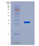 小鼠泛素羧基端酯酶L1(UCHL1)重组蛋白