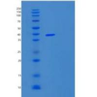 人UBXN2B重组蛋白