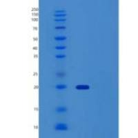 小鼠肿瘤坏死因子受体超家族成员5重组蛋白