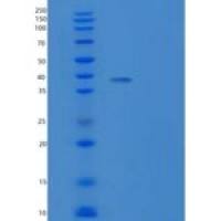 大鼠酪氨酸蛋白磷酸酶非受体型底物1重组蛋白