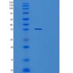 人TSNAX重组蛋白