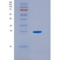 人泛素D(UBD)重组蛋白