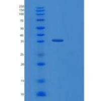 人Troponin T重组蛋白
