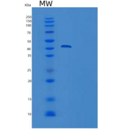 人TRIB3重组蛋白