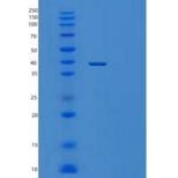 人tRNA wybutosine合成蛋白5（ty w5）重组蛋白
