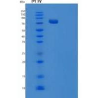 大肠杆菌TRS（苏氨酸合成酶）重组蛋白