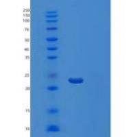 人髓细胞触发受体1(TREM1)重组蛋白