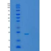 人UBE2W重组蛋白
