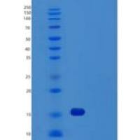 人TTC11重组蛋白