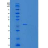 大肠杆菌尿嘧啶DNA糖基化酶(UNG)重组蛋白