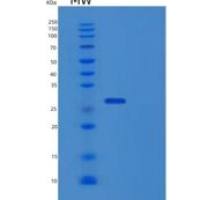 人硫嘌呤甲基转移酶(TPMT)重组蛋白