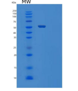 人TYRP1重组蛋白