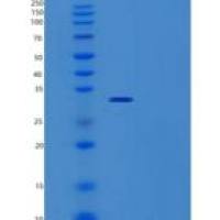 人TTC33重组蛋白