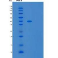 人泛素羧基端酯酶L5(UCHL5)重组蛋白