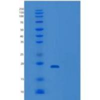 人UBE2N重组蛋白