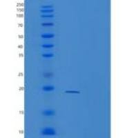 人TRAPPC2L重组蛋白