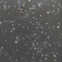 小鼠脑动脉平滑肌细胞/免疫荧光鉴定