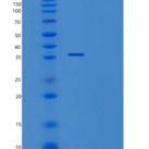 人尿嘧啶核苷磷酸化酶1(UPP1)重组蛋白
