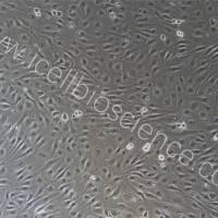 人肺大动脉内皮细胞  |  肺动脉内皮细胞  |  内皮细胞  |  免疫荧光鉴定  |  镜像绮