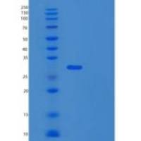 人UBE2K重组蛋白