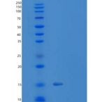 人TXNRD3NB重组蛋白