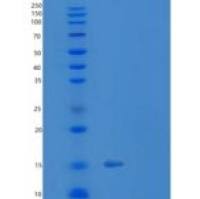 人TXNRD3NB重组蛋白