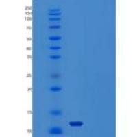 人四旋蛋白7(TSPAN7)重组蛋白