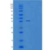 人TSSC4重组蛋白