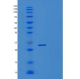 人肿瘤坏死因子相关凋亡诱导配体(TRAIL)重组蛋白