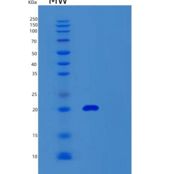 人泛素结合酶E2A(UBE2A)重组蛋白