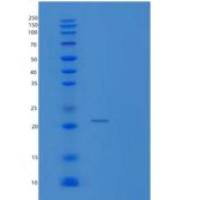 人TNFSF8重组蛋白