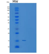 人TXNDC17重组蛋白