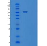 人TYRP1重组蛋白