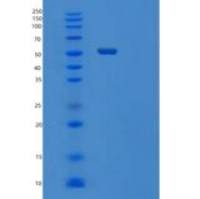 人TYRP1重组蛋白